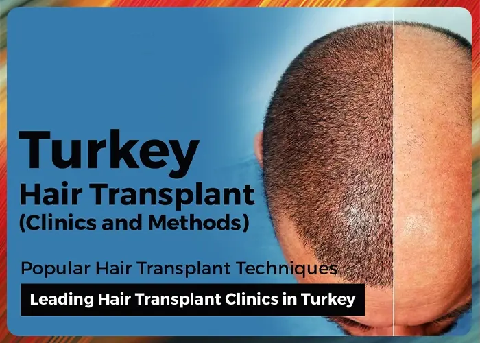 Hair Transplant in Turkey